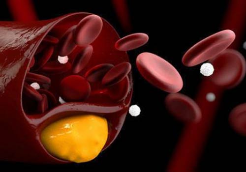 Fluorescenza rende il cardiovascolare