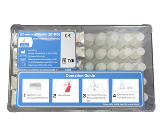 β2-microglobulina (946;2-MG) Test